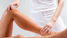 Como Prevenir e Tratar Varizes