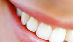 Mantenha seu sorriso bonito e evite doenças!