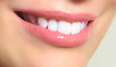 Clareamento Dental