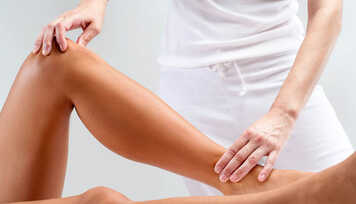 Como Prevenir e Tratar Varizes