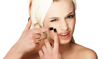 5 Suplementos que Eliminam a Acne