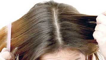 Soluções Naturais para a Caspa