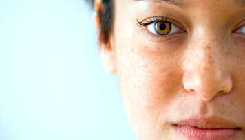 Nota 10 Nota 0 - Produtos Clareadores