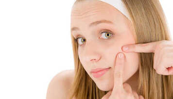 Tratamentos Naturais para Acne