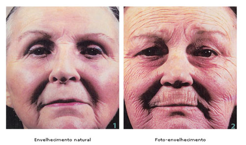 Tudo sobre Fotoproteção!